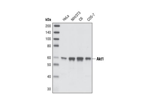 Phospho-Akt Isoform Antibody Sampler Kit