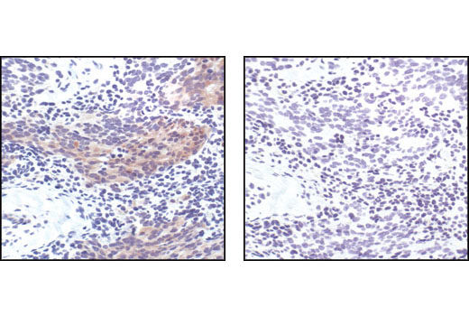 Pro-Apoptosis Bcl-2 Family Antibody Sampler Kit