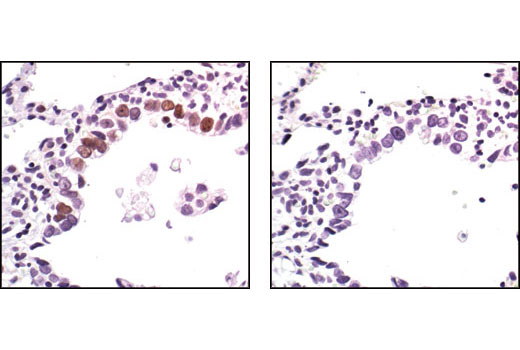 p53 Antibody Sampler Kit