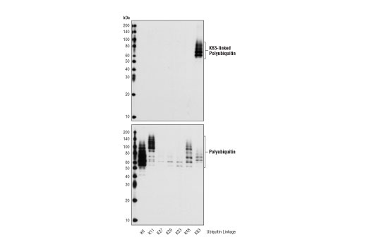 K63-linkage Specific Polyubiquitin (D7A11) Rabbit mAb