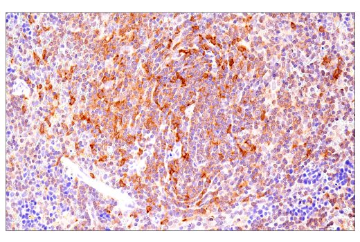 NF-kappaB Family Member Antibody Sampler Kit