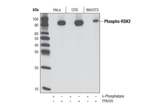 Phospho-RSK2 (Ser227) (D53A11) Rabbit mAb