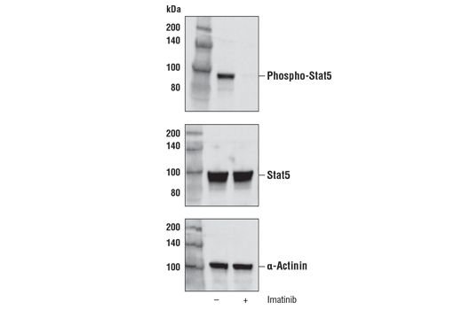 Imatinib