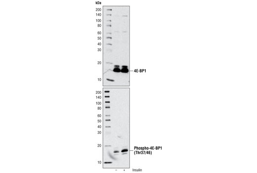 mTOR Substrates Antibody Sampler Kit