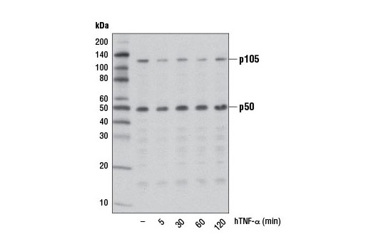 NF-kappaB Family Member Antibody Sampler Kit