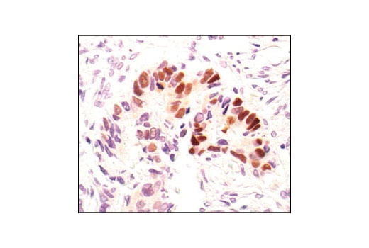p53 Antibody Sampler Kit