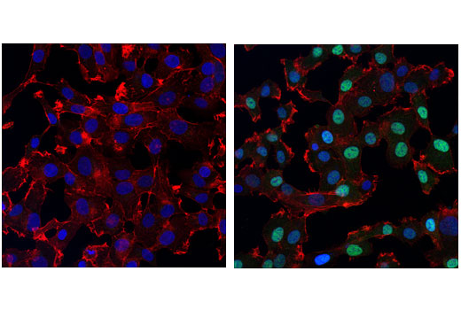 SMAD 1/5/9 Antibody Sampler Kit