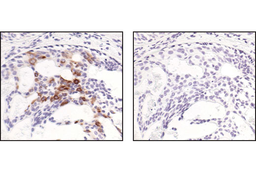 NF-kappaB Pathway Antibody Sampler Kit