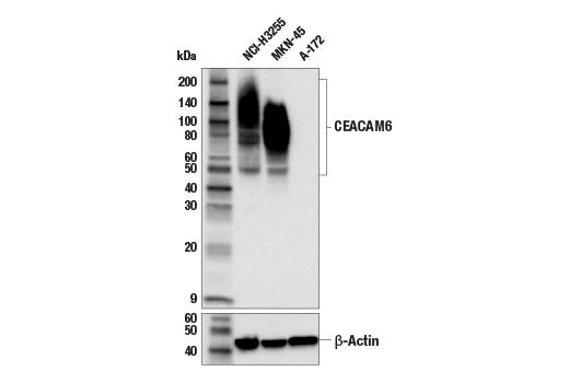 CEACAM6 (E7S7Y) Rabbit mAb