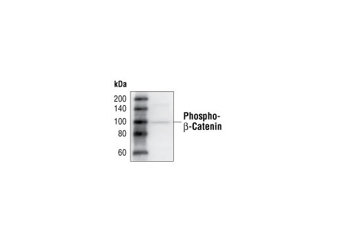 Phospho-beta-Catenin (Ser33/37/Thr41) Antibody