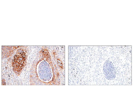 Exosomal Marker Antibody Sampler Kit