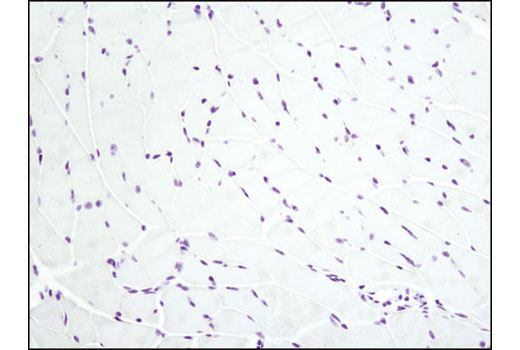 Ki-67 (D3B5) Rabbit mAb (IHC Formulated)