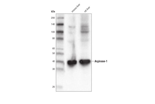 Arginase-1 (D4E3M™) XP ®  Rabbit mAb