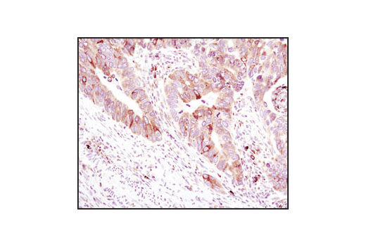 ER Stress-induced Autophagy Antibody Sampler Kit