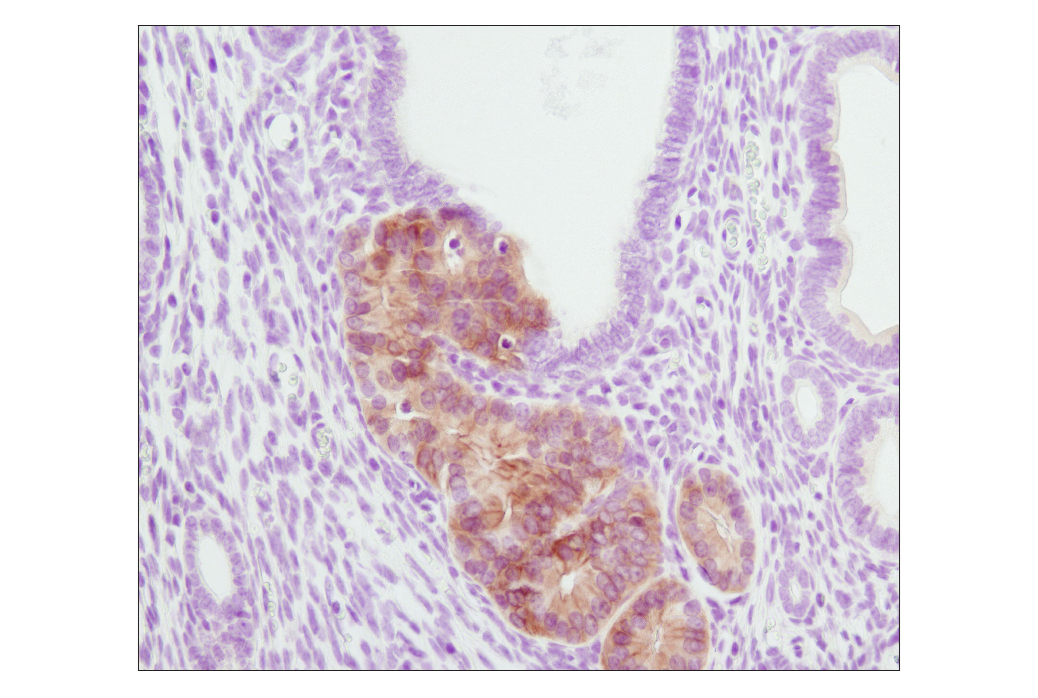 Angiogenesis Antibody Sampler Kit