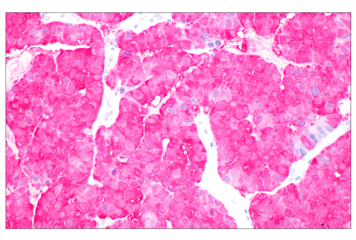 SignalStain ®  Boost IHC Detection Reagent (AP, Rat)