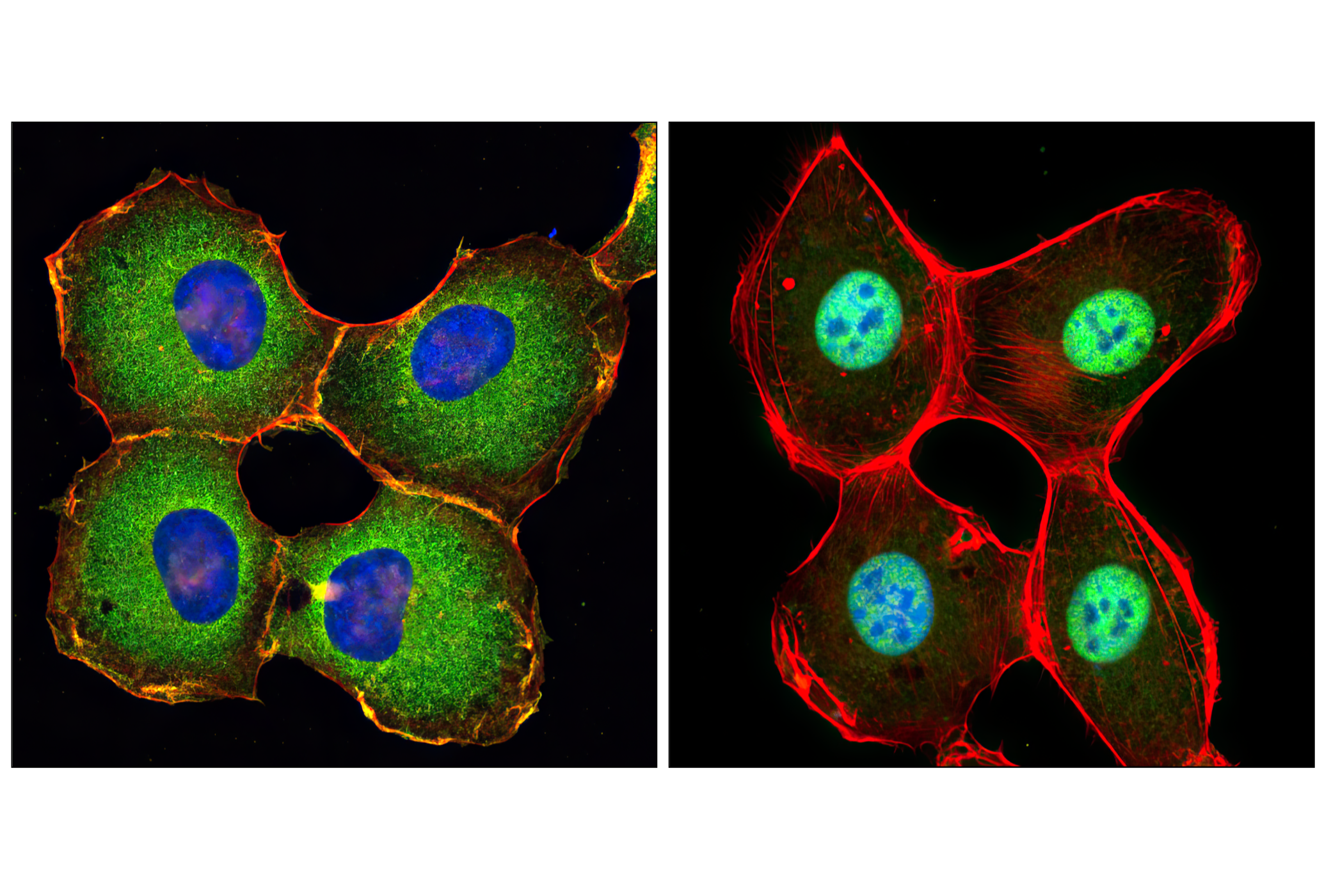 NF-kappaB Pathway Antibody Sampler Kit