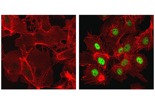 Hypoxia Pathway Antibody Sampler Kit