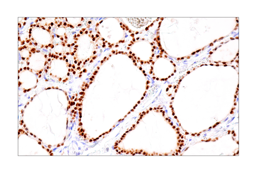 PAX8 (BC12) Mouse mAb