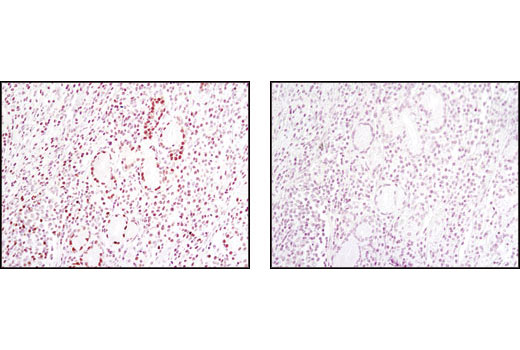 Wnt/beta-Catenin Activated Targets Antibody Sampler Kit