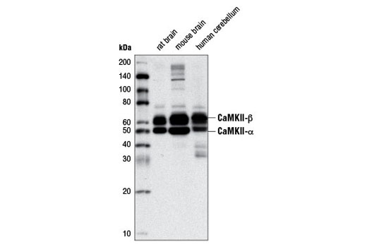 Phospho-CaMKII (Thr286) (D21E4) Rabbit mAb