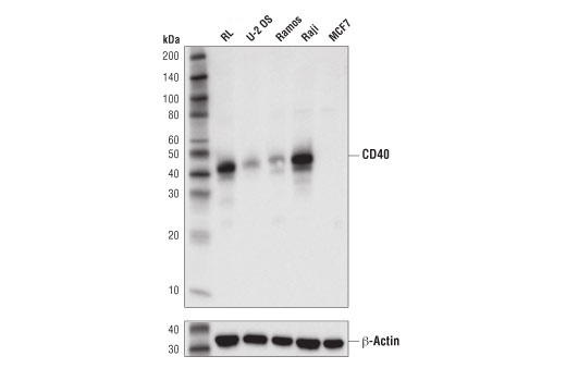 CD40 (D8W3N) Rabbit mAb