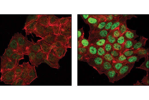 p53 Antibody Sampler Kit