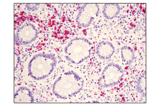 SignalStain ®  Boost IHC Detection Reagent (AP, Rabbit)