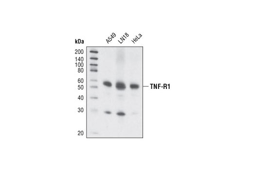 Death Receptor Antibody Sampler Kit