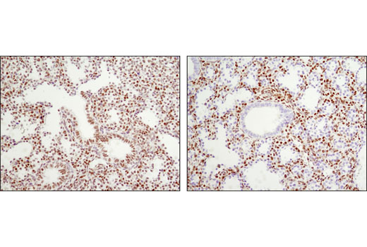 Notch Receptor Interaction Antibody Sampler Kit