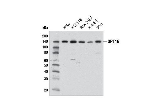 SPT16 (D7I2K) Rabbit mAb