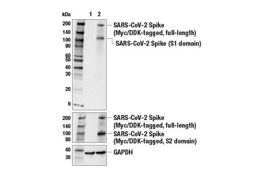 SARS-CoV-2 Spike Protein (S1) (E5S3V) Rabbit mAb