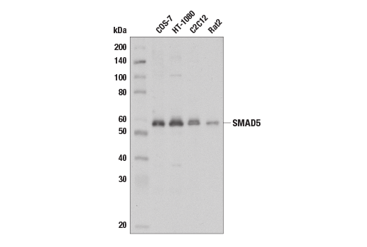 SMAD 1/5/9 Antibody Sampler Kit