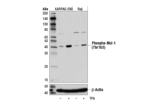 Pro-Survival Bcl-2 Family Antibody Sampler Kit II