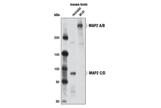 MAP2 (D5G1) XP ®  Rabbit mAb