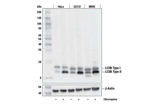 LC3B (E5Q2K) Mouse mAb