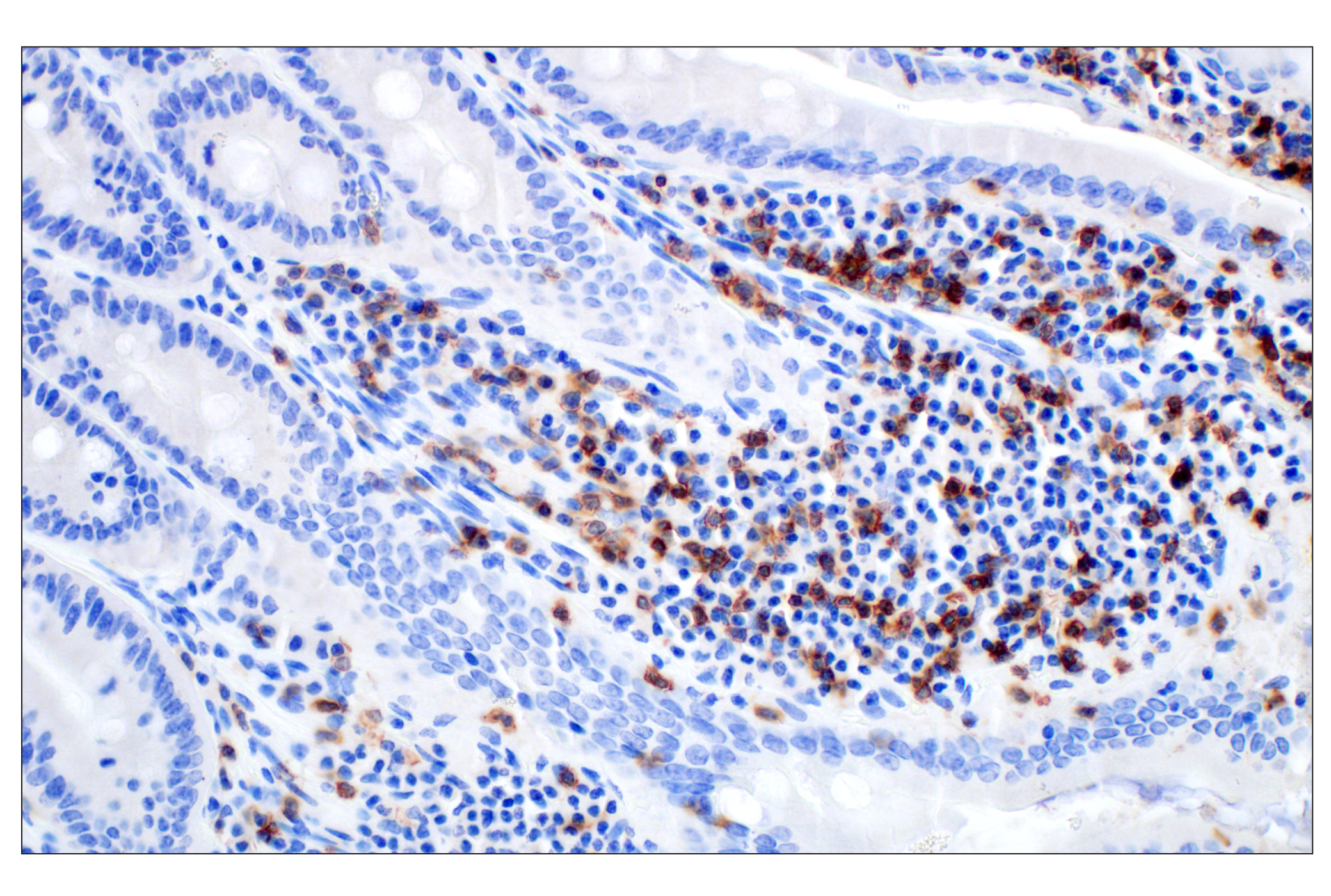 Mouse Immune Cell Phenotyping IHC Antibody Sampler Kit