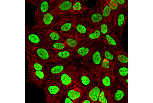 Methyl-Histone H3 (Lys9) Antibody Sampler Kit