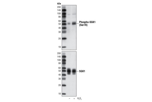 Phospho-SGK1 (Ser78) (D36D11) Rabbit mAb