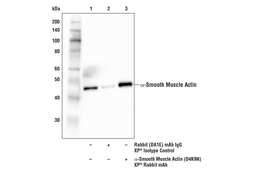 Cancer Associated Fibroblast Marker Antibody Sampler Kit