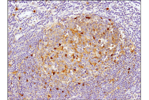 NF-kappaB Family Antibody Sampler Kit II