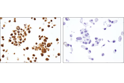 NF-kappaB Family Antibody Sampler Kit II