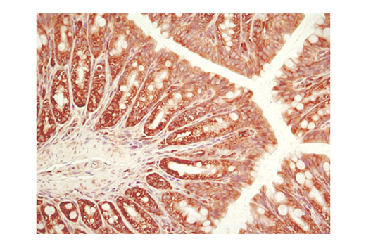 ER Stress-induced Autophagy Antibody Sampler Kit