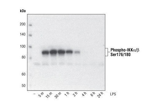 Phospho-IKKalpha-beta -Ser176-180- -16A6- Rabbit mAb_CST_优宁维(univ)商城