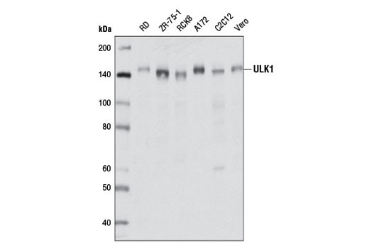 ULK1 (D8H5) Rabbit mAb