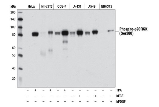 Phospho-Erk1/2 Pathway Antibody Sampler Kit