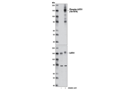 Phospho-LATS1 (Thr1079) (D57D3) Rabbit mAb