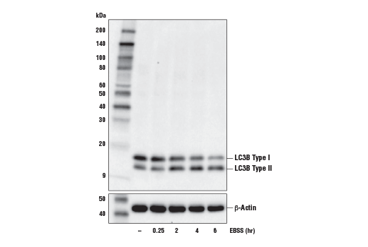 LC3B (E5Q2K) Mouse mAb