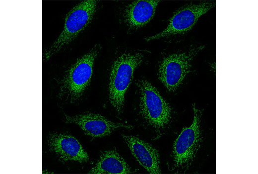 Pro-Survival Bcl-2 Family Antibody Sampler Kit II