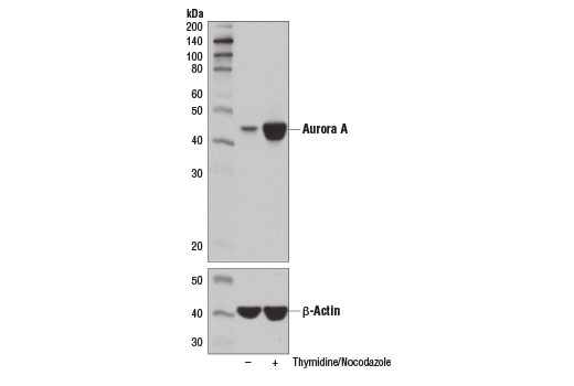 Aurora A (D3E4Q) Rabbit mAb